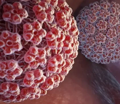 Ο HPV είναι ένας ιός 